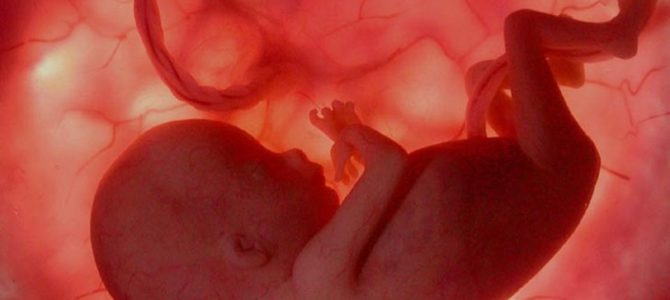 Di aborto si continua a parlare……….. (II Parte)
